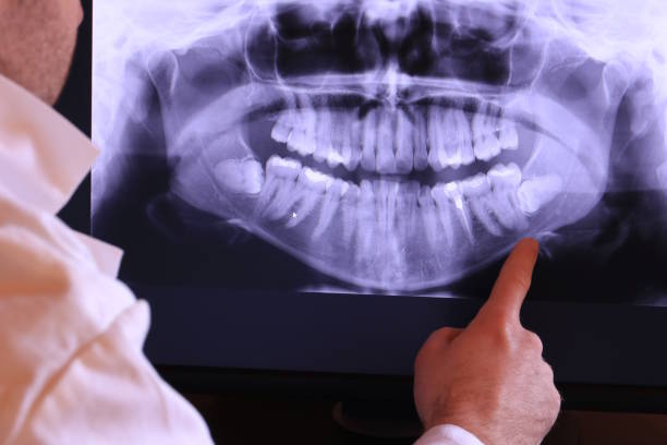 Best Emergency Treatment for Jaw Pain or Injury in Connelly Springs, NC