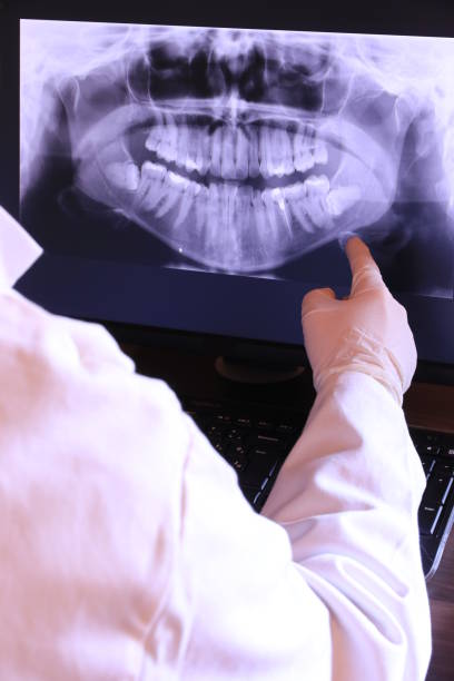 Best Emergency Care for Gum Disease in Connelly Springs, NC