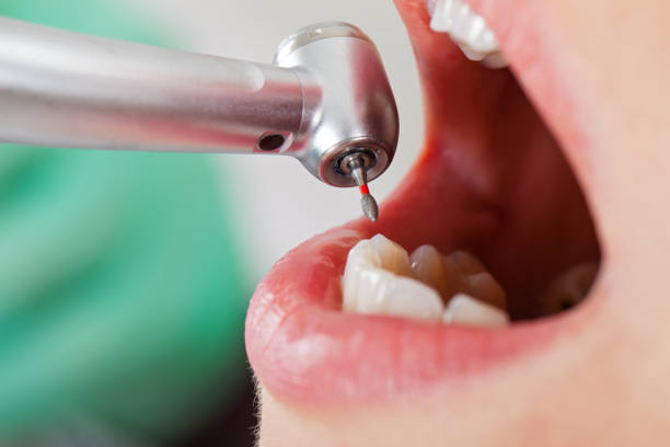 Best Emergency Treatment for Oral Infections in Connelly Springs, NC